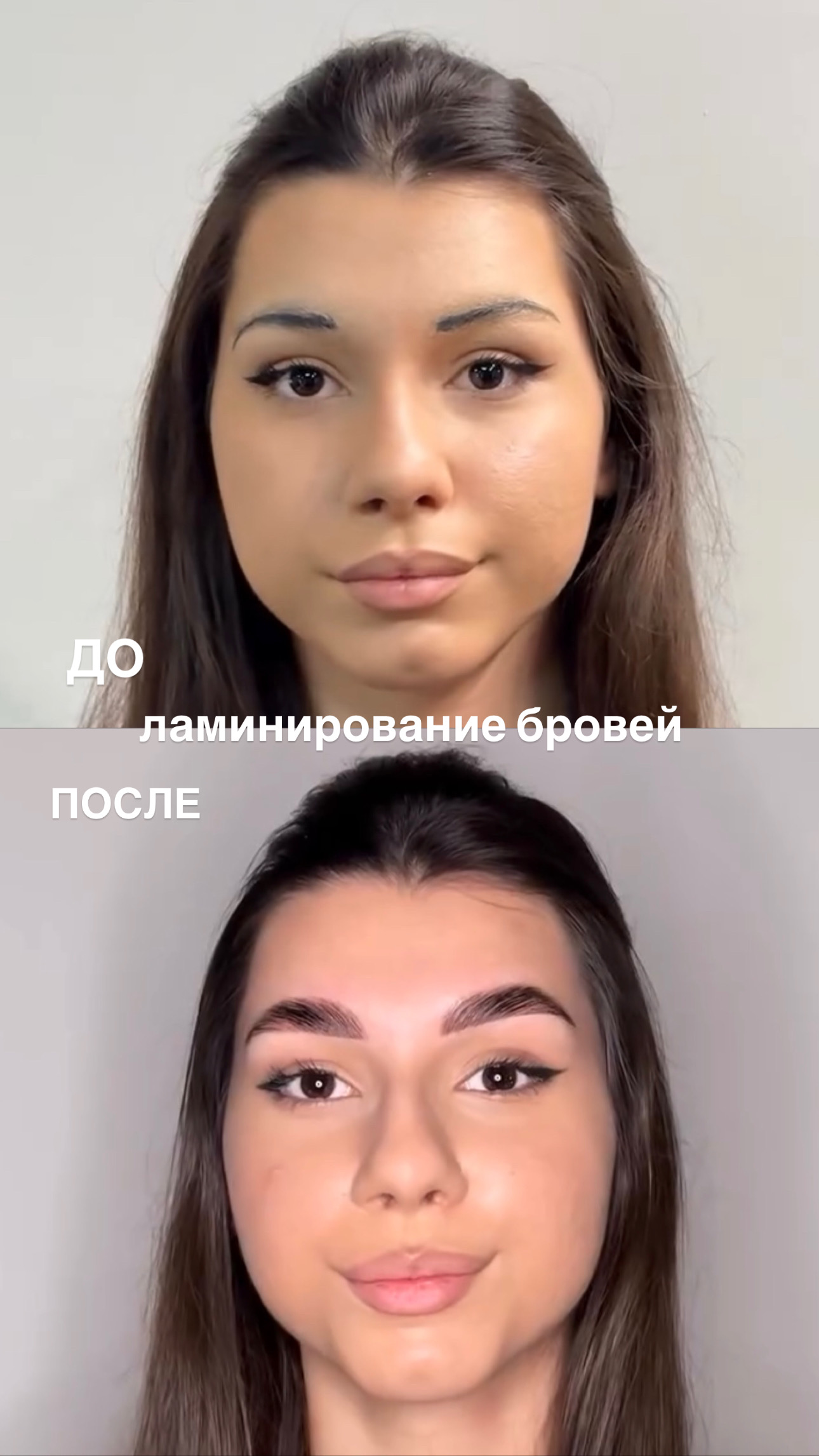 Результат лазерной эпиляции — до и после в студии Блонди и Брю Махачкала