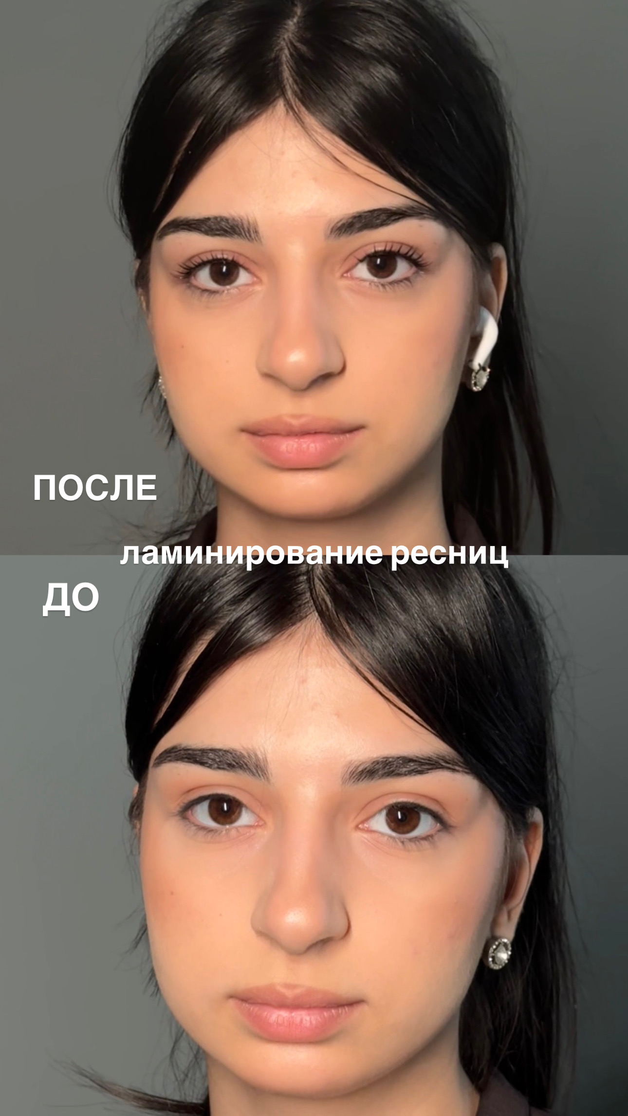 Результат лазерной эпиляции — до и после в студии Блонди и Брю Махачкала